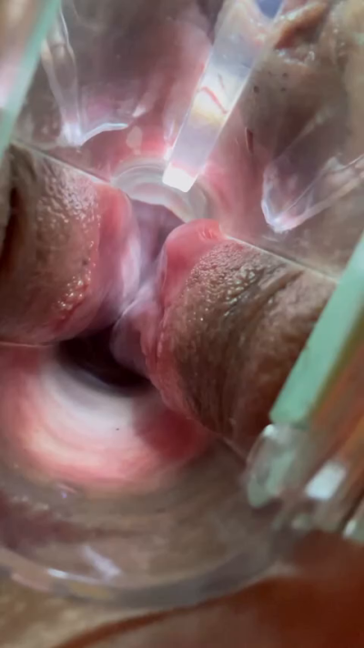 chubbyholes